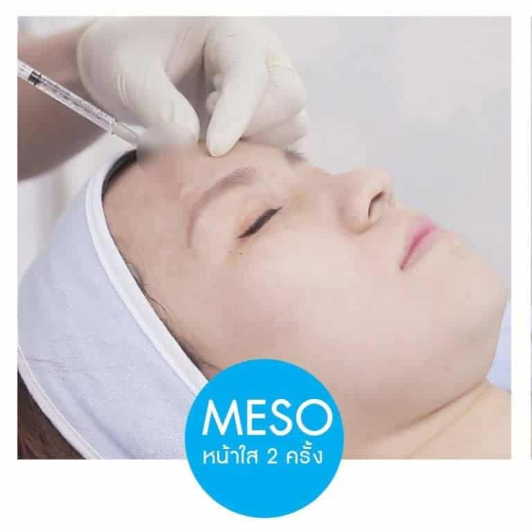 Meso หน้าใส by charmer clinic