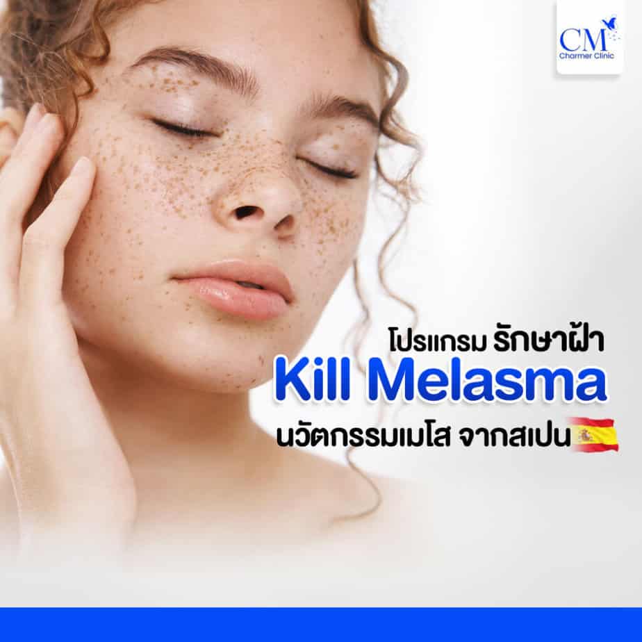Kill-Melasmaโปรแกรมรักษาฝ้า
