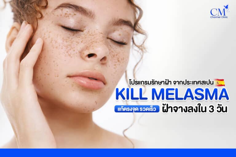 Kill-Melasmaโปรแกรมรักษาฝ้า-2