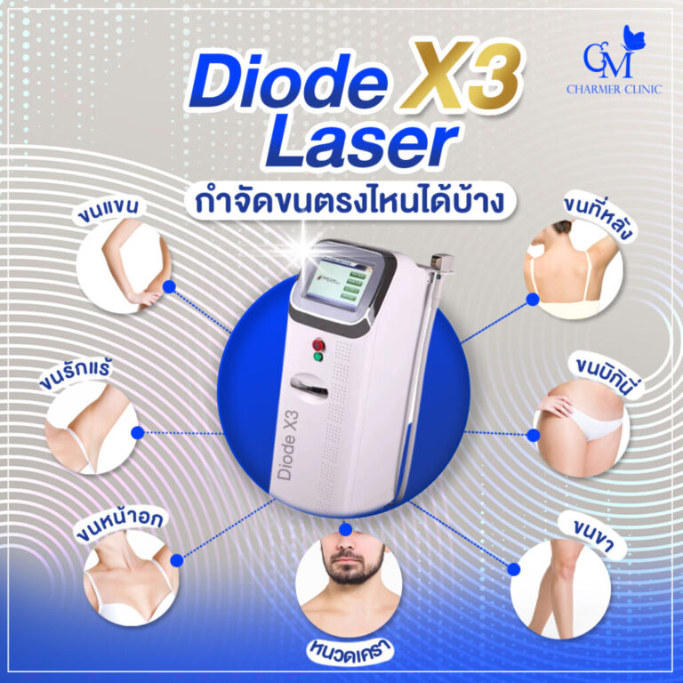 กำจัดขนด้วยกำจัดขนด้วยไดโอดเลเซอร์ (diode laser )จากชาเมอร์ คลินิก