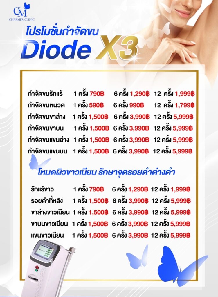 diode laser